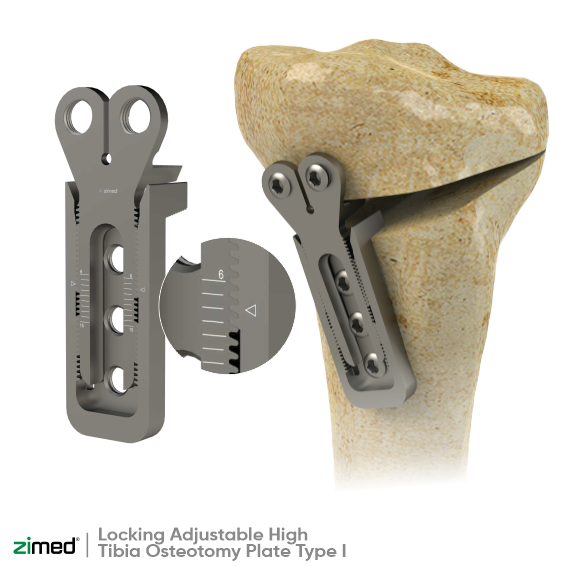 High Tibial Osteotomy Plate
