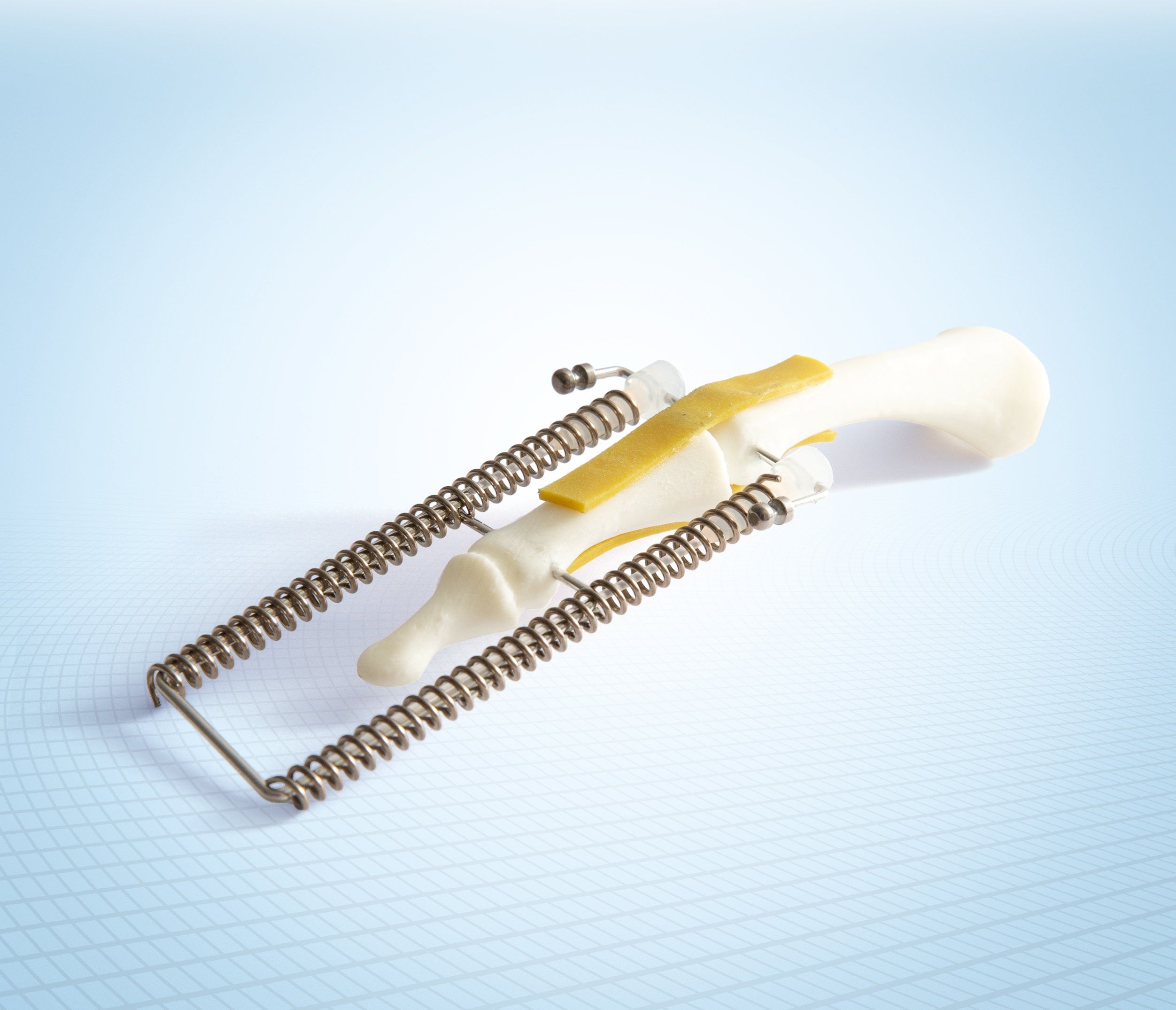 Universal Tendon Spacer